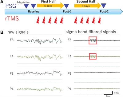 Local and Transient Changes of Sleep Spindle Density During Series of Prefrontal Repetitive Transcranial Magnetic Stimulation in Patients With a Major Depressive Episode